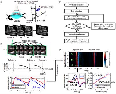 Noninvasive Aortic Ultrafast Pulse Wave Velocity Associated With Framingham Risk Model: in vivo Feasibility Study